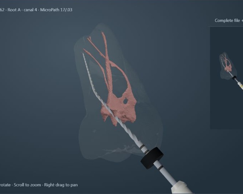 Complete molar ACTA 0062